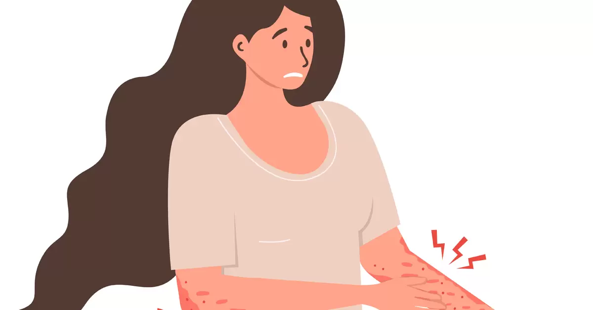 What's the Difference Between Psoriasis and Eczema?